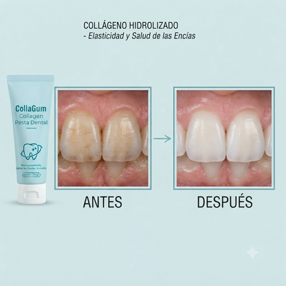¡NUEVA PRESENTACIÓN! COLLAGUM | Pasta Dental de Colágeno para Fortalecer Encías y Esmalte